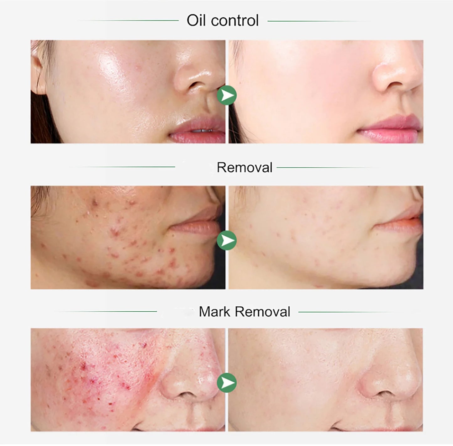 AILKE Turmeric Whitening Ritual