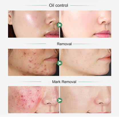 AILKE Turmeric Whitening Ritual
