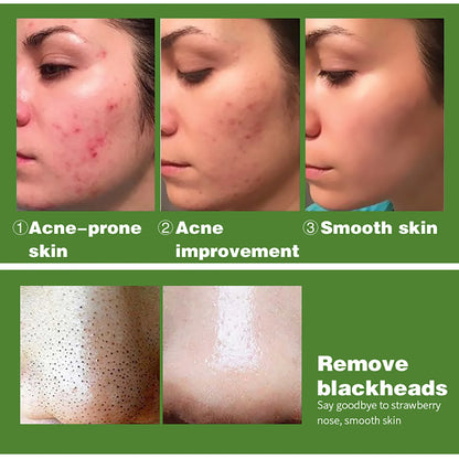 AILKE Turmeric Whitening Ritual
